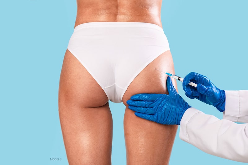 Rear view of a woman's backside while a cosmetic surgeon holds a syringe against her buttocks